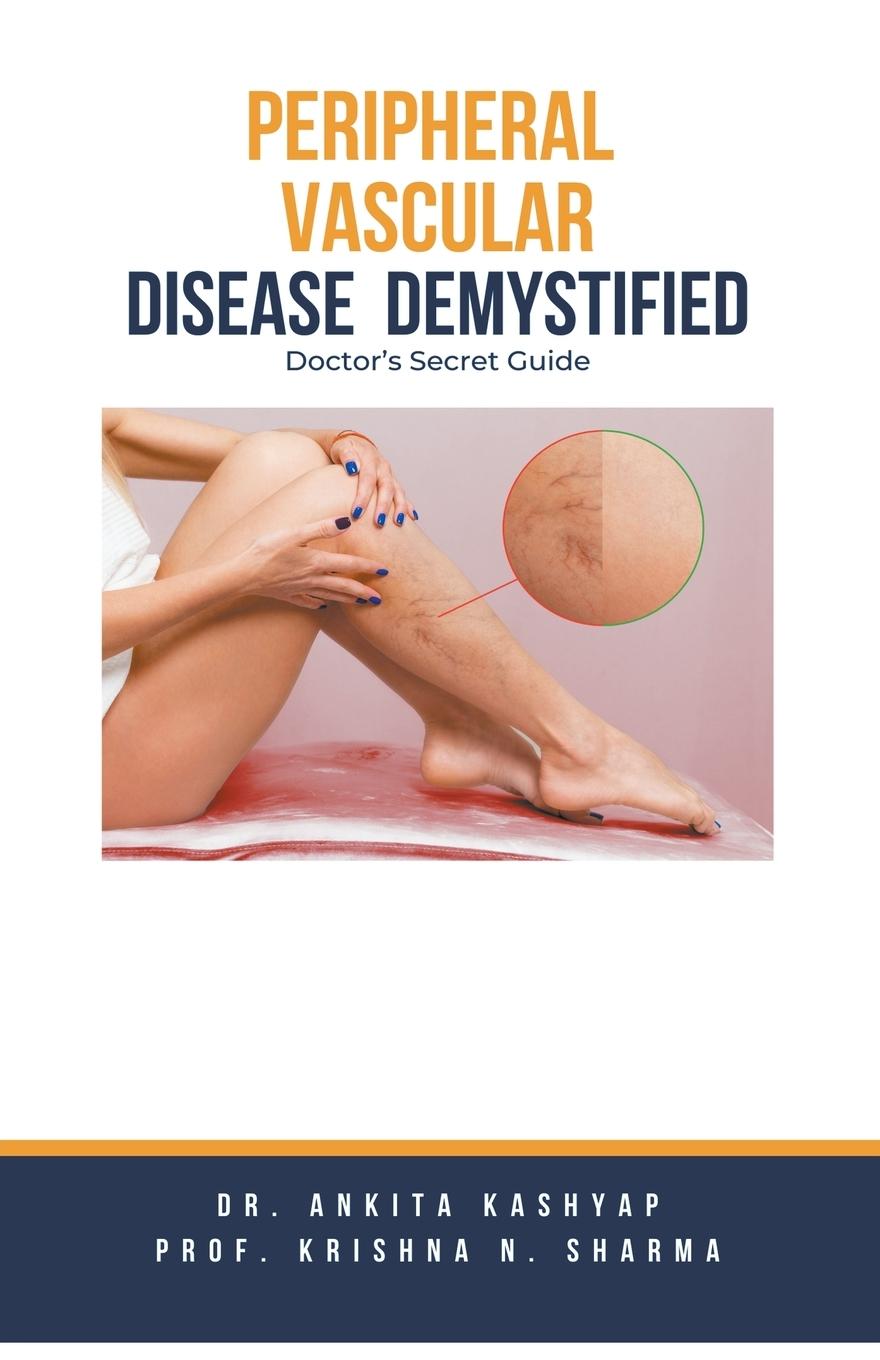 Книга Peripheral Vascular Disease Demystified Krishna N. Sharma