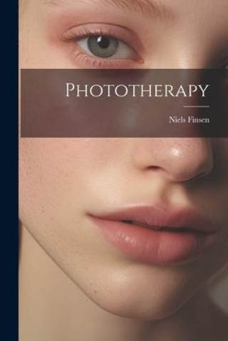 Knjiga Phototherapy Niels Finsen