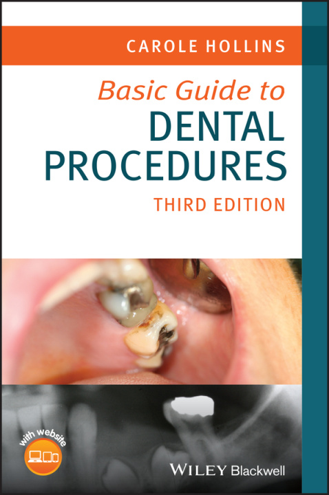 Book Basic Guide to Dental Procedures, 3rd Edition 