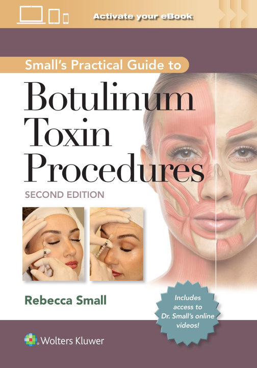 Książka Small's Practical Guide to Botulinum Toxin Procedures Rebecca Small
