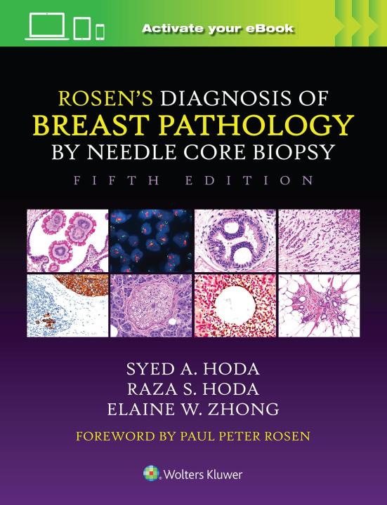 Kniha Rosen's Diagnosis of Breast Pathology by Needle Core Biopsy Syed A. Hoda