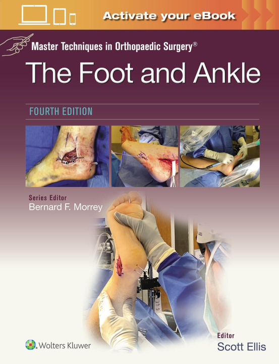 Buch Master Techniques in Orthopaedic Surgery: The Foot and Ankle SCOTT ELLIS