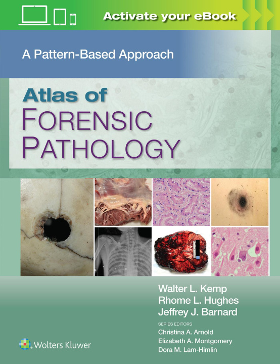 Kniha Atlas of Forensic Pathology: A Pattern Based Approach Walter L. Kemp