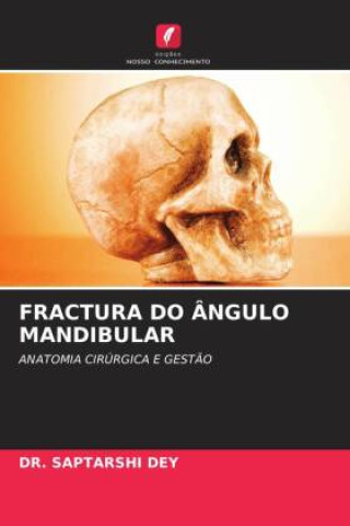 Knjiga FRACTURA DO ÂNGULO MANDIBULAR DR. SAPTARSHI DEY