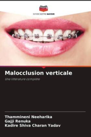 Book Malocclusion verticale Gajji Renuka