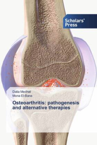 Book Osteoarthritis: pathogenesis and alternative therapies Mona El-Bana