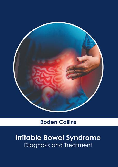 Book Irritable Bowel Syndrome: Diagnosis and Treatment 