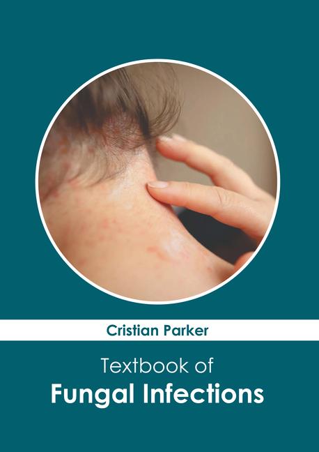 Könyv Textbook of Fungal Infections 