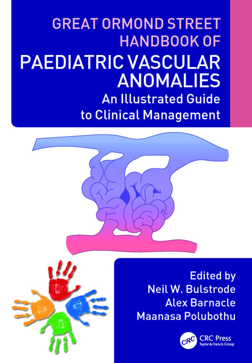 Kniha Great Ormond Street Handbook of Paediatric Vascular Anomalies 