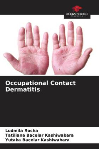 Knjiga Occupational Contact Dermatitis Tatiliana Bacelar Kashiwabara