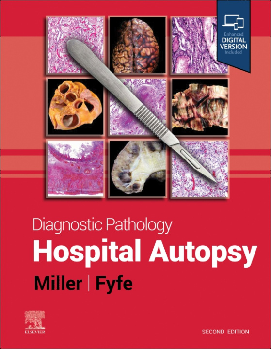 Carte Diagnostic Pathology: Hospital Autopsy Billie S. Fyfe