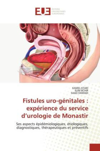 Carte Fistules uro-génitales : expérience du service d?urologie de Monastir Slim Bchir