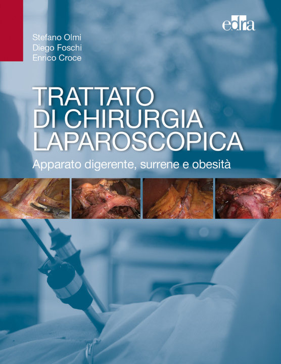 Книга Trattato di chirurgia laparoscopica. Apparato digerente, surrene e obesità Stefano Olmi