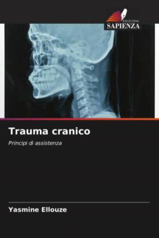 Knjiga Trauma cranico Yasmine Ellouze