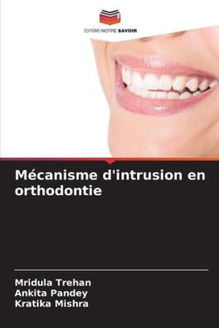 Kniha Mécanisme d'intrusion en orthodontie Ankita Pandey
