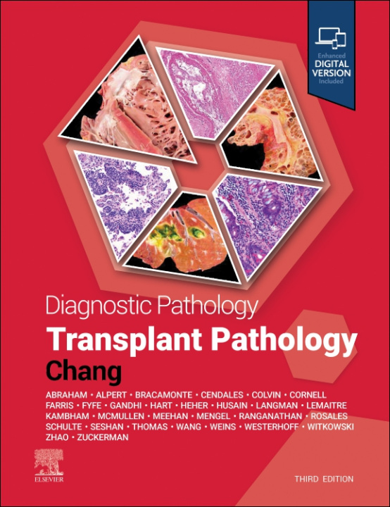 Könyv Diagnostic Pathology: Transplant Pathology Anthony Chang