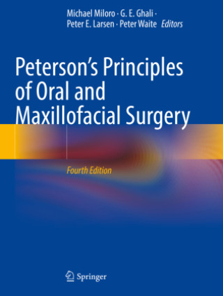 Carte Peterson's Principles of Oral and Maxillofacial Surgery, 2 Teile Michael Miloro