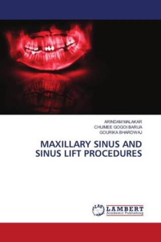 Buch MAXILLARY SINUS AND SINUS LIFT PROCEDURES Chuimee Gogoi Barua