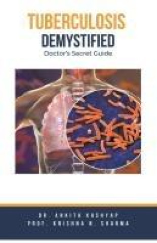 Knjiga Tuberculosis Demystified Krishna N. Sharma