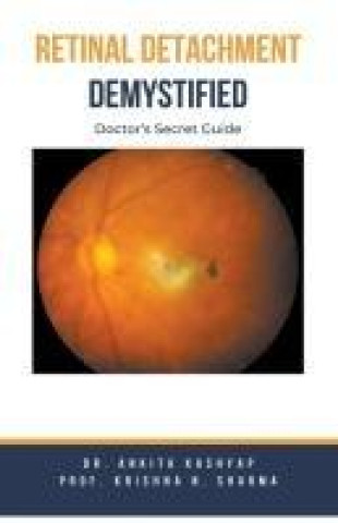 Knjiga Retinal Detachment Demystified Krishna N. Sharma