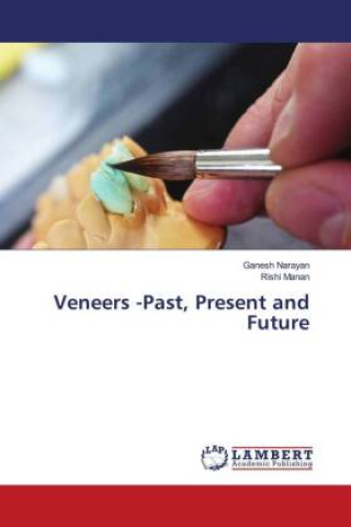 Knjiga Veneers -Past, Present and Future Rishi Manan