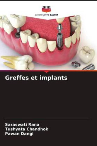 Book Greffes et implants Saraswati Rana
