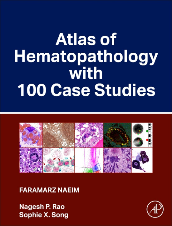 Könyv Atlas of Hematopathology with 100 Case Studies Faramarz Naeim