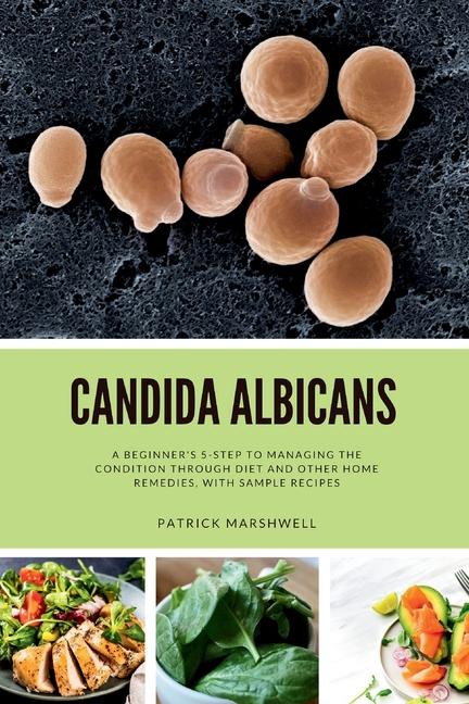 Knjiga Candida Albicans: A Beginner's 5-Step to Managing the Condition Through Diet and Other Home Remedies, With Sample Recipes 