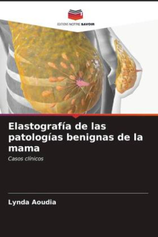 Kniha Elastografía de las patologías benignas de la mama 
