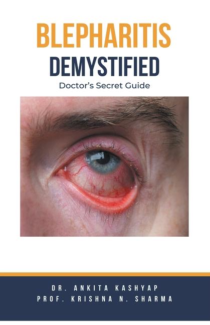 Knjiga Blepharitis Demystified Krishna N. Sharma