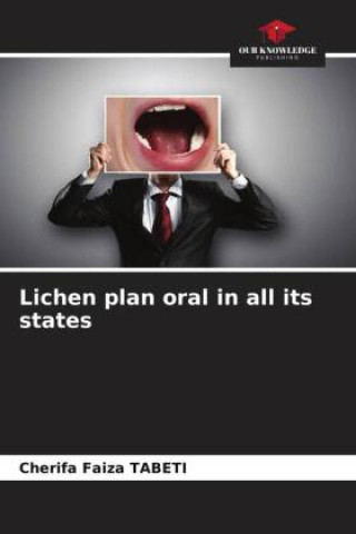 Книга Lichen plan oral in all its states Cherifa Faiza TABETI
