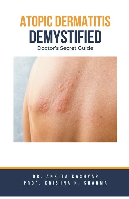 Kniha Atopic Dermatitis Demystified: Doctor's Secret Guide Krishna N. Sharma