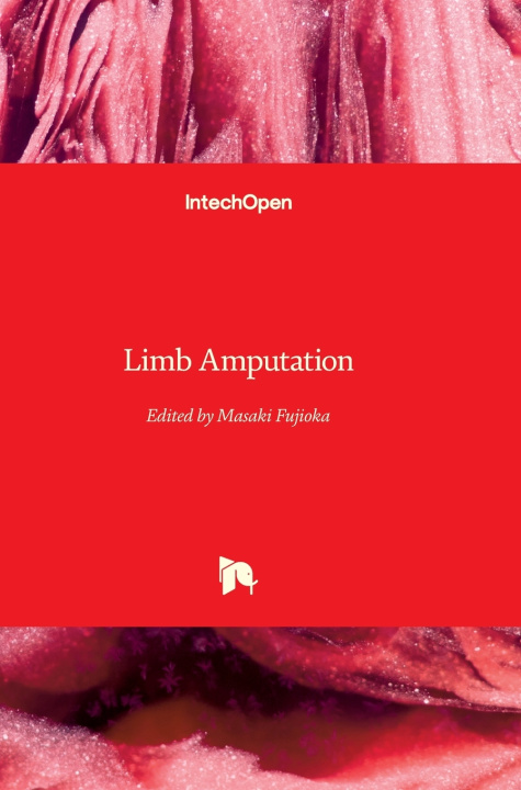 Knjiga Limb Amputation Masaki Fujioka