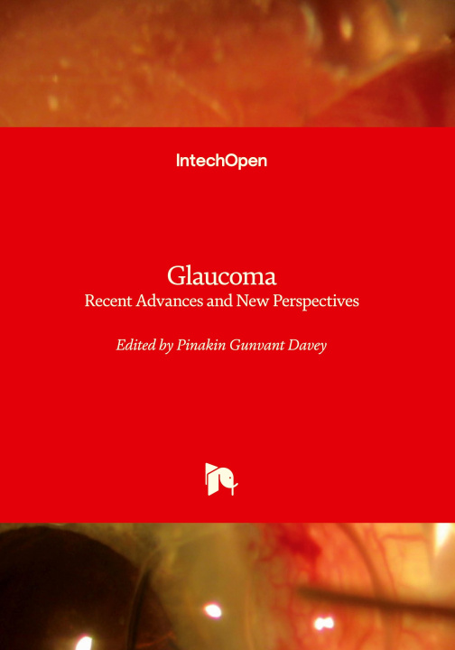 Knjiga Glaucoma 
