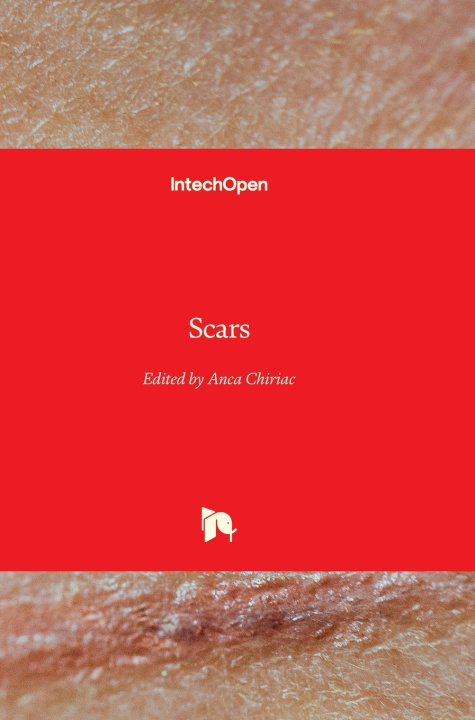 Knjiga Scars Anca Chiriac
