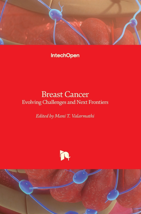 Kniha Breast Cancer Mani T. Valarmathi