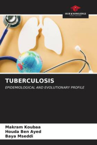 Book TUBERCULOSIS Houda Ben Ayed