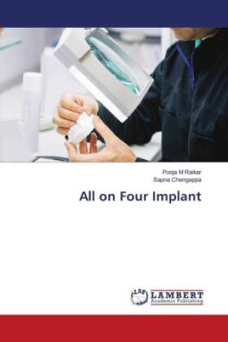 Könyv All on Four Implant Sapna Chengappa