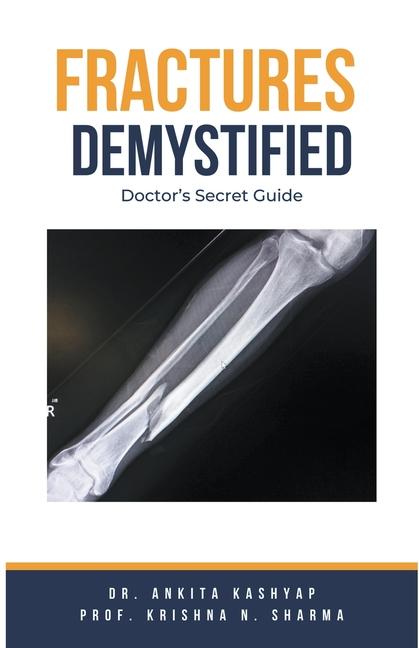 Knjiga Fractures Demystified Krishna N. Sharma