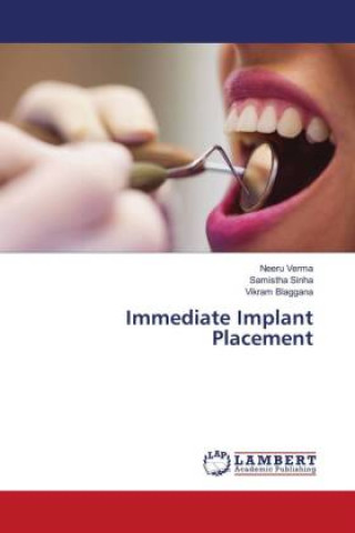 Libro Immediate Implant Placement Samistha Sinha