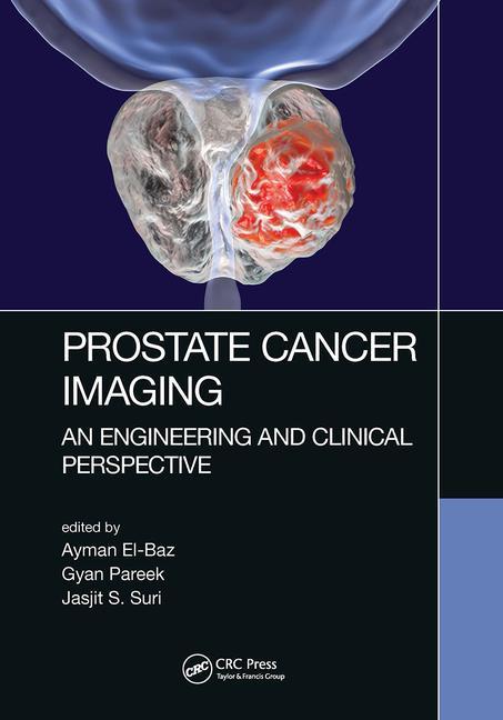 Book Prostate Cancer Imaging Ayman El-Baz