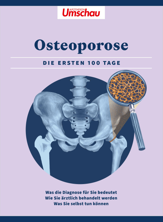 Kniha Apotheken Umschau: Osteoporose 