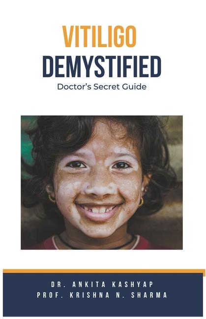 Kniha Vitiligo Demystified Doctors Secret Guide Krishna N. Sharma