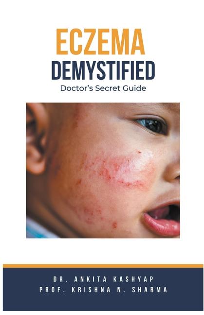 Kniha Eczema Demystified: Doctor's Secret Guide Krishna N. Sharma