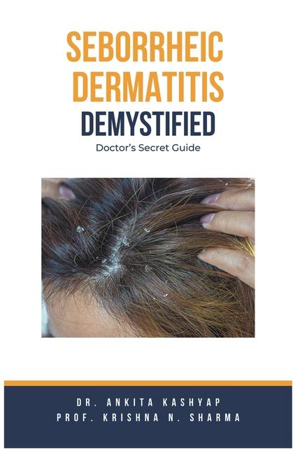 Könyv Seborrheic Dermatitis Demystified: Doctor's Secret Guide Krishna N. Sharma