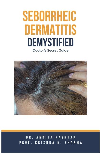 Book Seborrheic Dermatitis Demystified: Doctor's Secret Guide Krishna N. Sharma