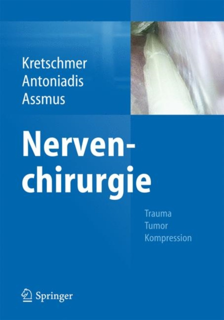 E-kniha Nervenchirurgie Thomas Kretschmer