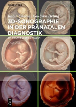 Kniha 3D-Sonographie in der pränatalen Diagnostik Rabih Chaoui