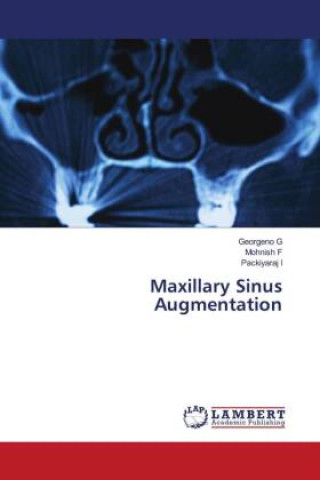 Kniha Maxillary Sinus Augmentation Georgeno G