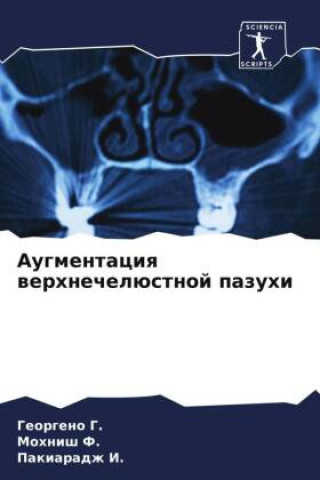 Boek Augmentaciq werhnechelüstnoj pazuhi Mohnish F.